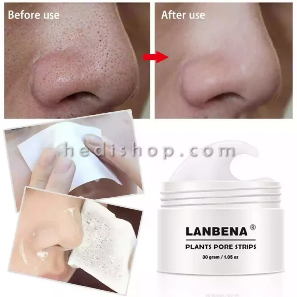 چسب بینی ضد جوش سرسیاه لانبنا LANBENA (6)